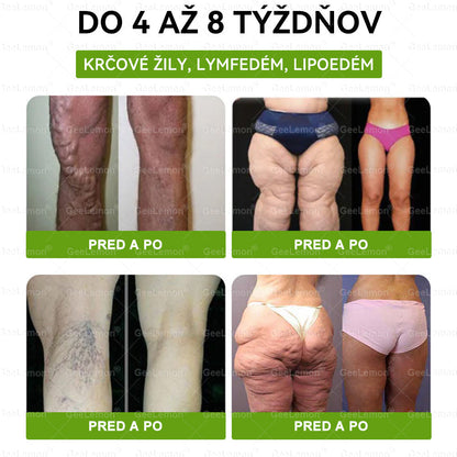 Odporúčané UNB · 👩‍⚕️Oficiálny obchod Dr. Max | 🎁 𝐆𝐞𝑒𝐿𝑒𝐦𝐨𝐧® Glumasetide 8 v 1 Nano mikrotŕňový náplasť – Len raz denne ✅ Viditeľné zmeny za 7 dní na obezitu, ochabnutú pokožku a zdravie